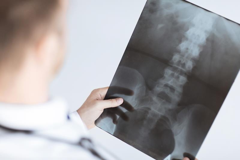 X-Rays Saddle River, NJ